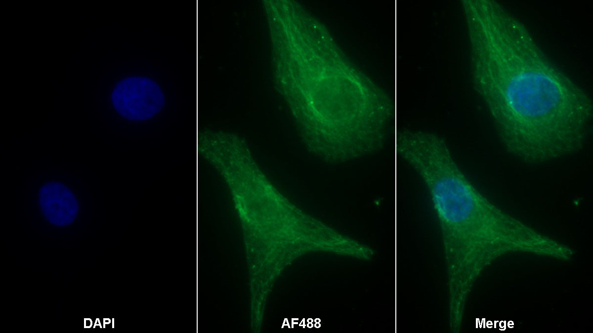 Monoclonal Antibody to S100 Calcium Binding Protein P (S100P)