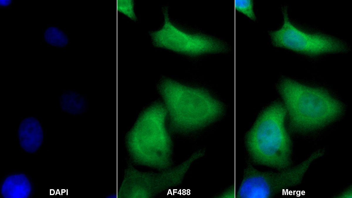 Monoclonal Antibody to S100 Calcium Binding Protein P (S100P)