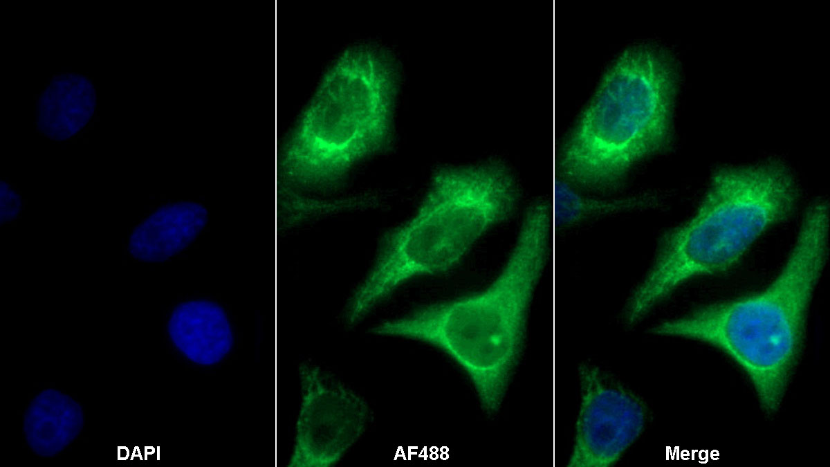 Monoclonal Antibody to S100 Calcium Binding Protein P (S100P)