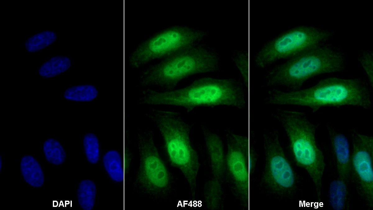 Monoclonal Antibody to S100 Calcium Binding Protein P (S100P)