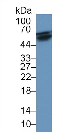 Monoclonal Antibody to Receptor Activator Of Nuclear Factor Kappa B (RANk)