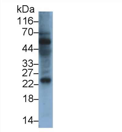 Monoclonal Antibody to Interleukin 24 (IL24)