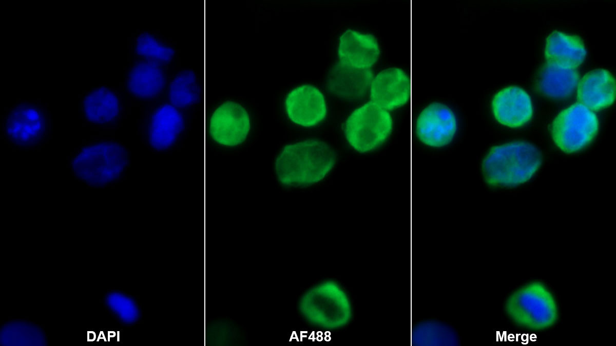 Monoclonal Antibody to Growth Differentiation Factor 3 (GDF3)