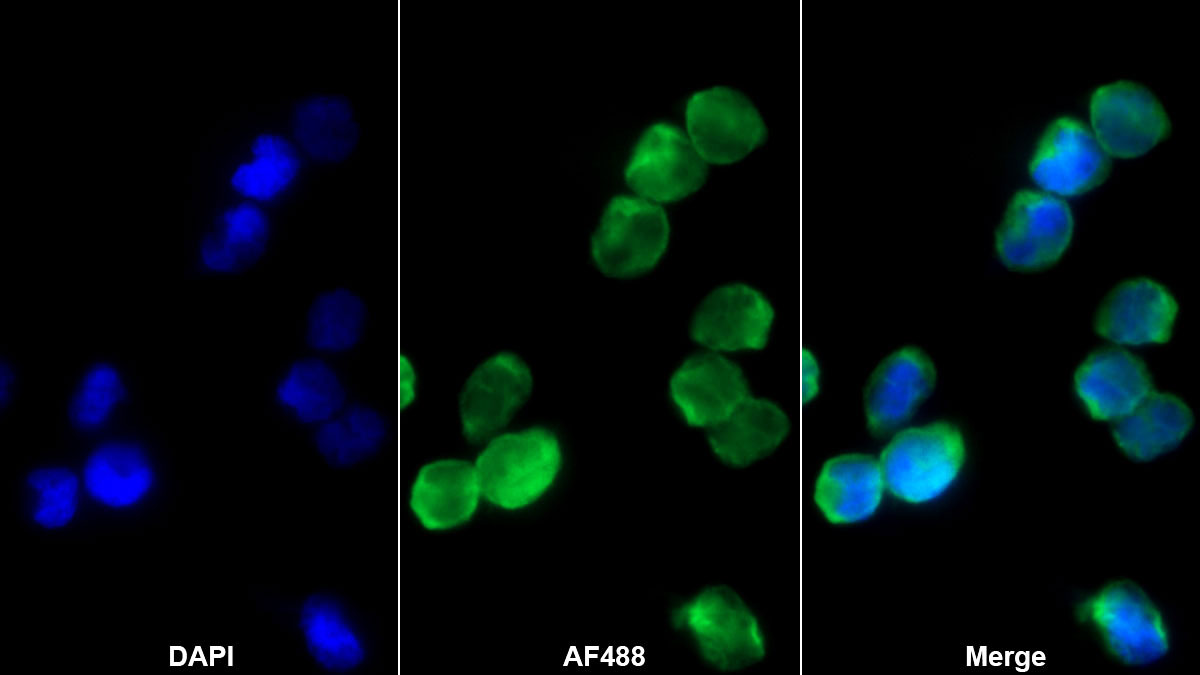 Monoclonal Antibody to Growth Differentiation Factor 3 (GDF3)