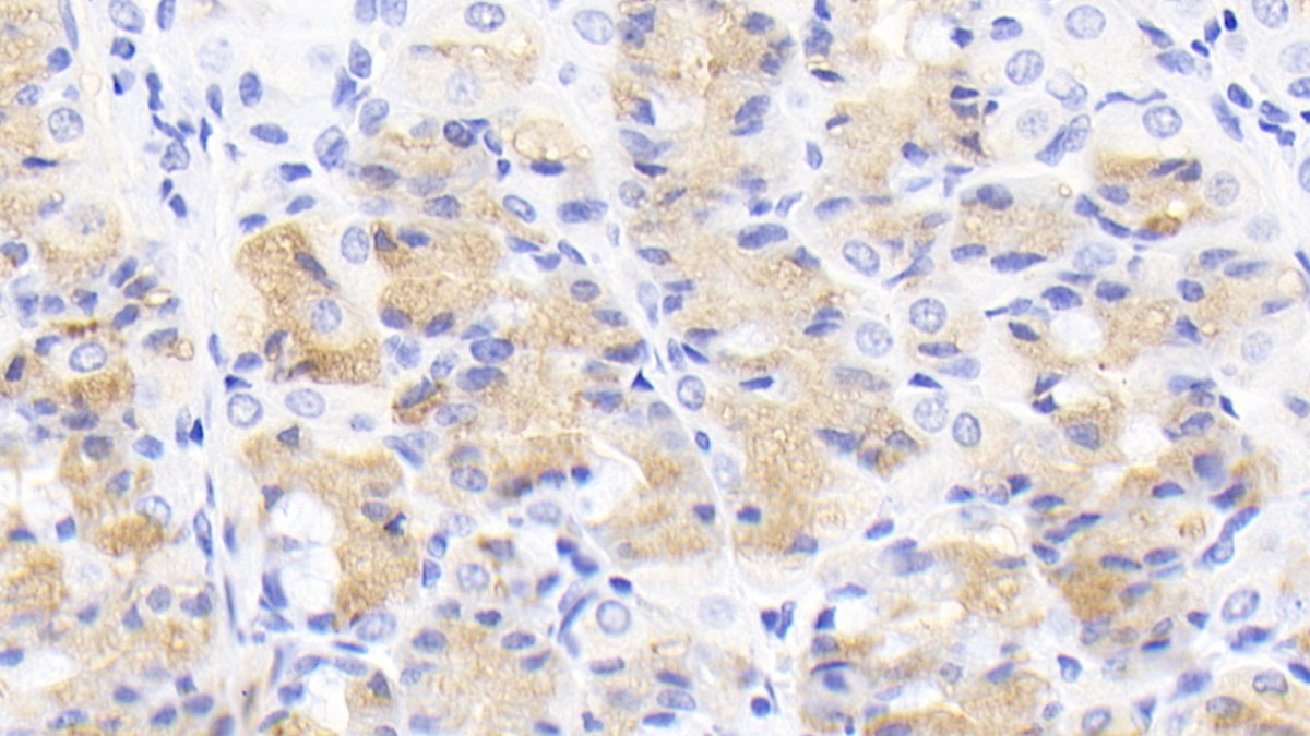 Monoclonal Antibody to Activin A Receptor Type II A (ACVR2A)