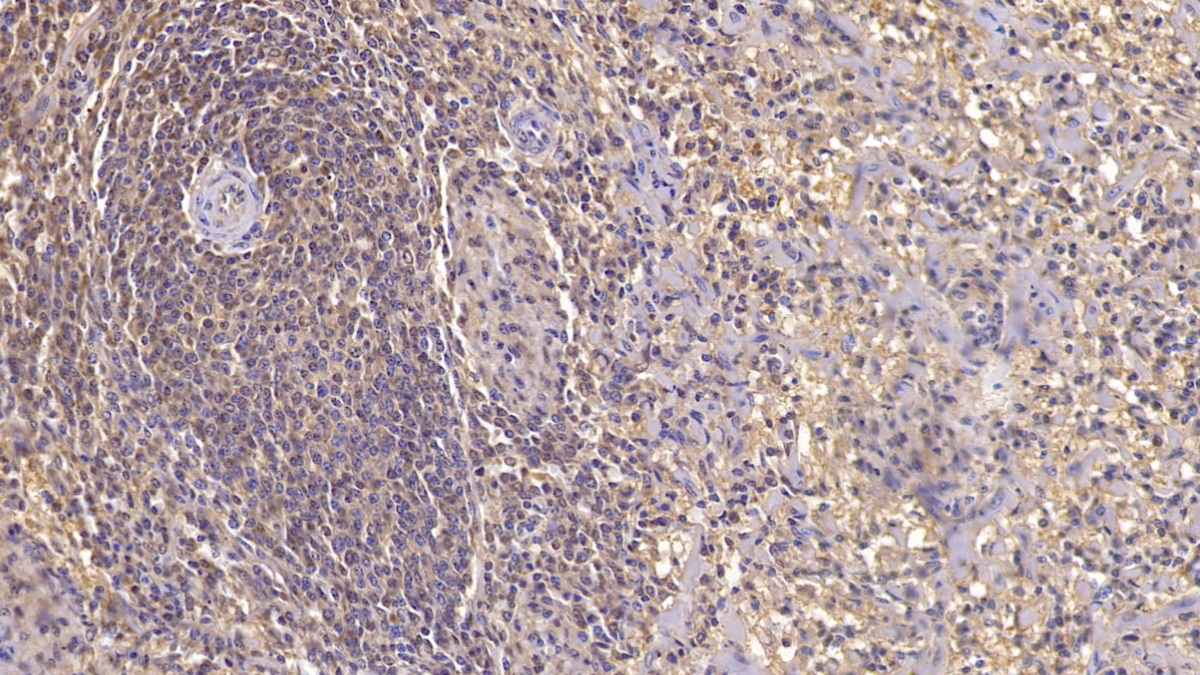 Monoclonal Antibody to Activin A Receptor Type II A (ACVR2A)