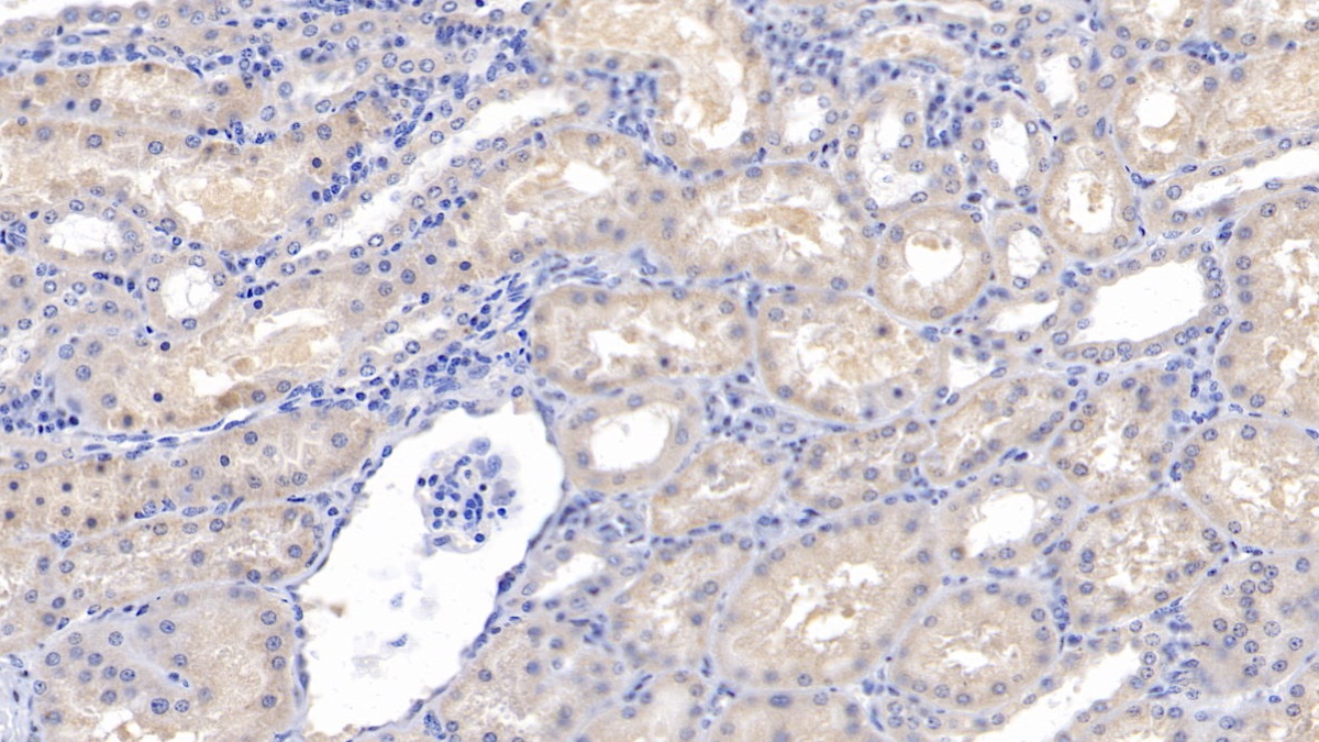 Monoclonal Antibody to Activin A Receptor Type II A (ACVR2A)