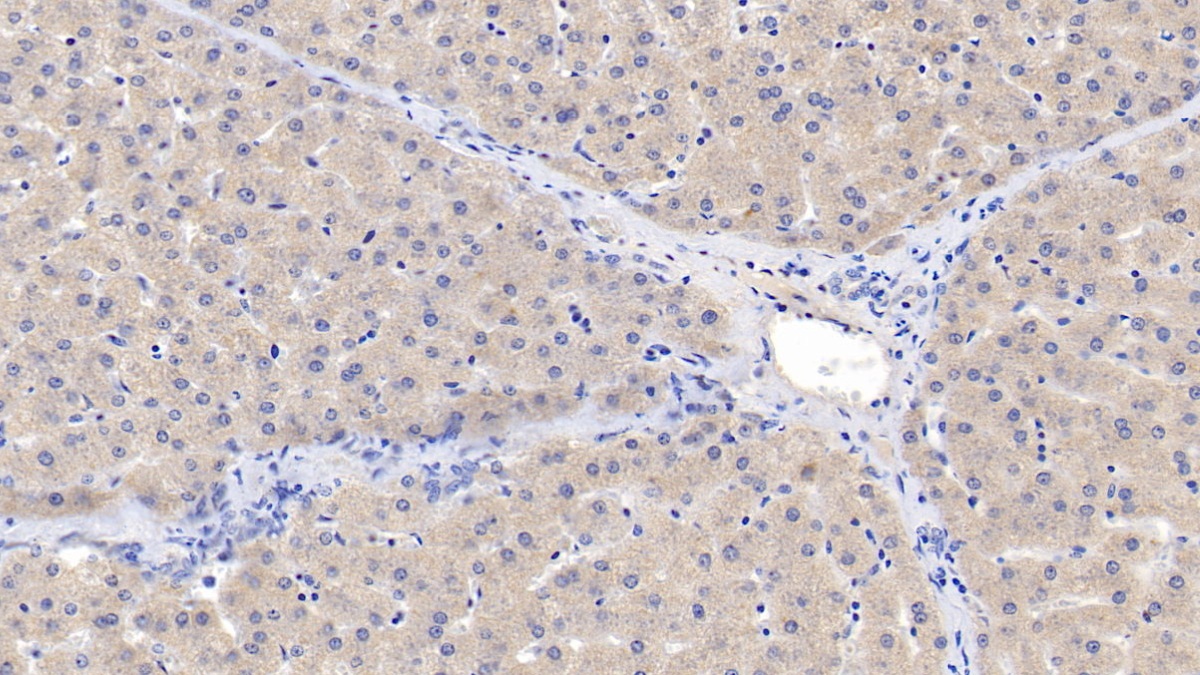 Monoclonal Antibody to Activin A Receptor Type II A (ACVR2A)