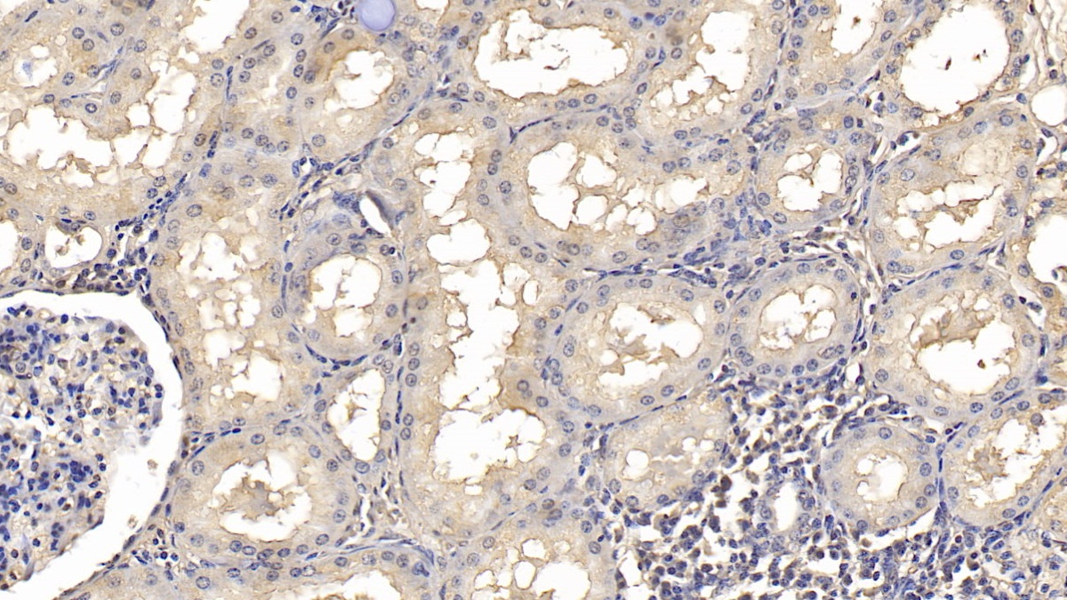 Monoclonal Antibody to SMAD family member 3 (SMAD3)