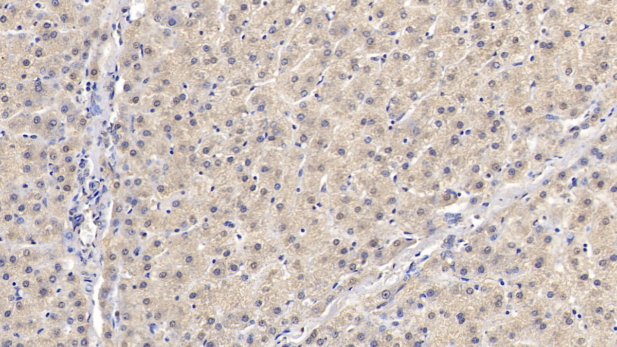 Monoclonal Antibody to SMAD family member 3 (SMAD3)