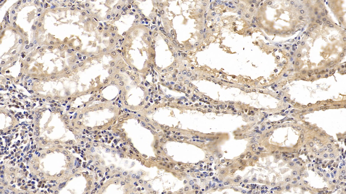 Monoclonal Antibody to SMAD family member 3 (SMAD3)