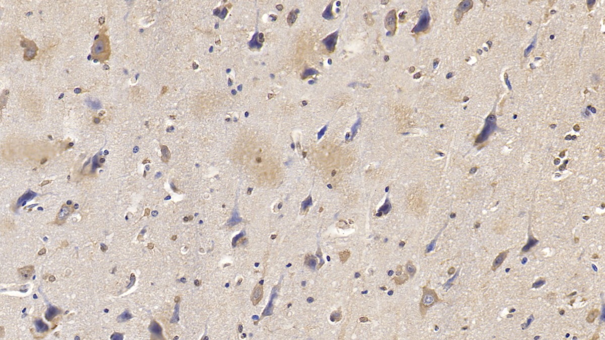 Monoclonal Antibody to SMAD family member 3 (SMAD3)