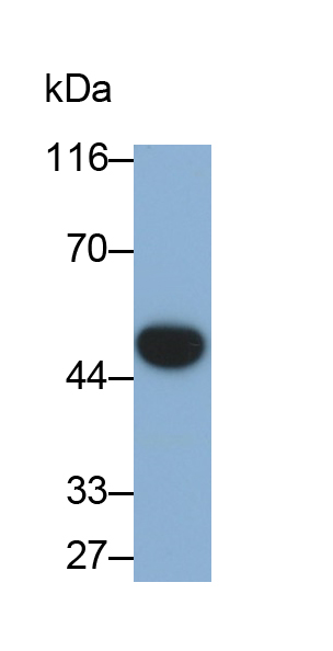 Monoclonal Antibody to SMAD family member 3 (SMAD3)