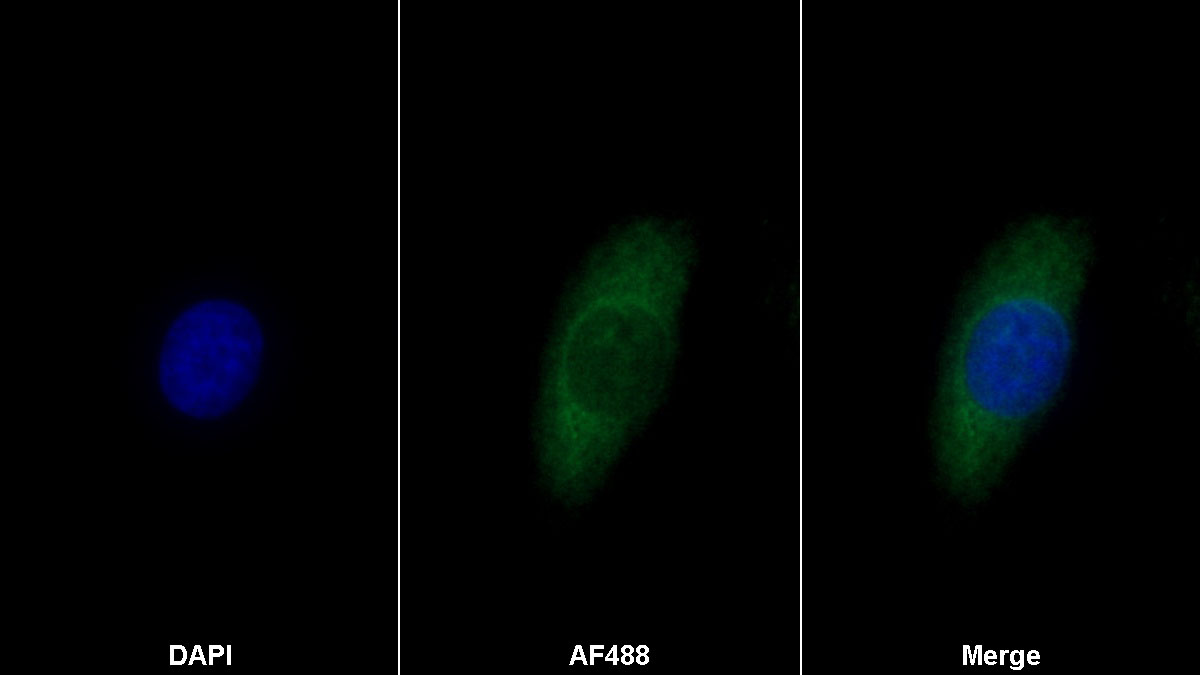 Monoclonal Antibody to Collagen Type IV Alpha 5 (COL4a5)