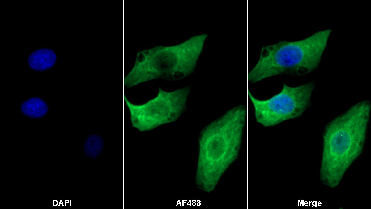 Monoclonal Antibody to Collagen Type IV Alpha 3 (COL4a3)