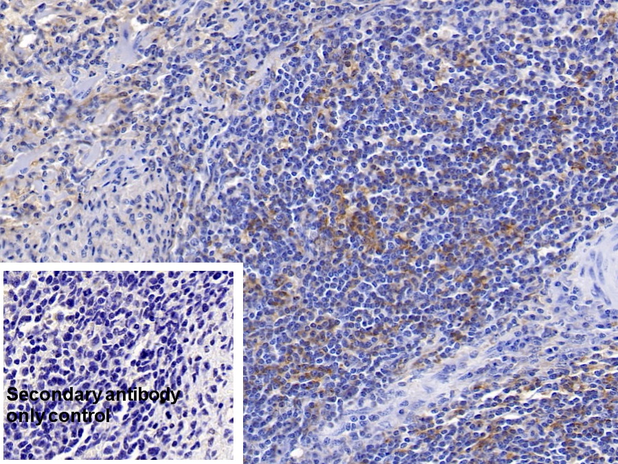 Monoclonal Antibody to HLA Class II Histocompatibility Antigen, DRB1 Beta Chain (HLA-DRB1)