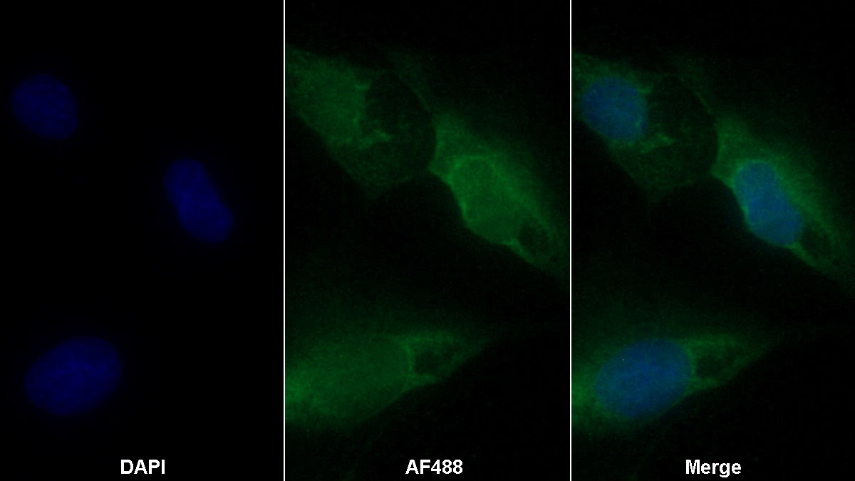 Monoclonal Antibody to Axis Inhibition Protein 2 (AXIN2)