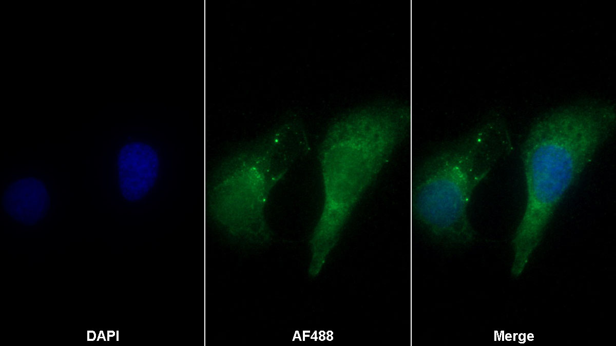 Monoclonal Antibody to Axis Inhibition Protein 2 (AXIN2)