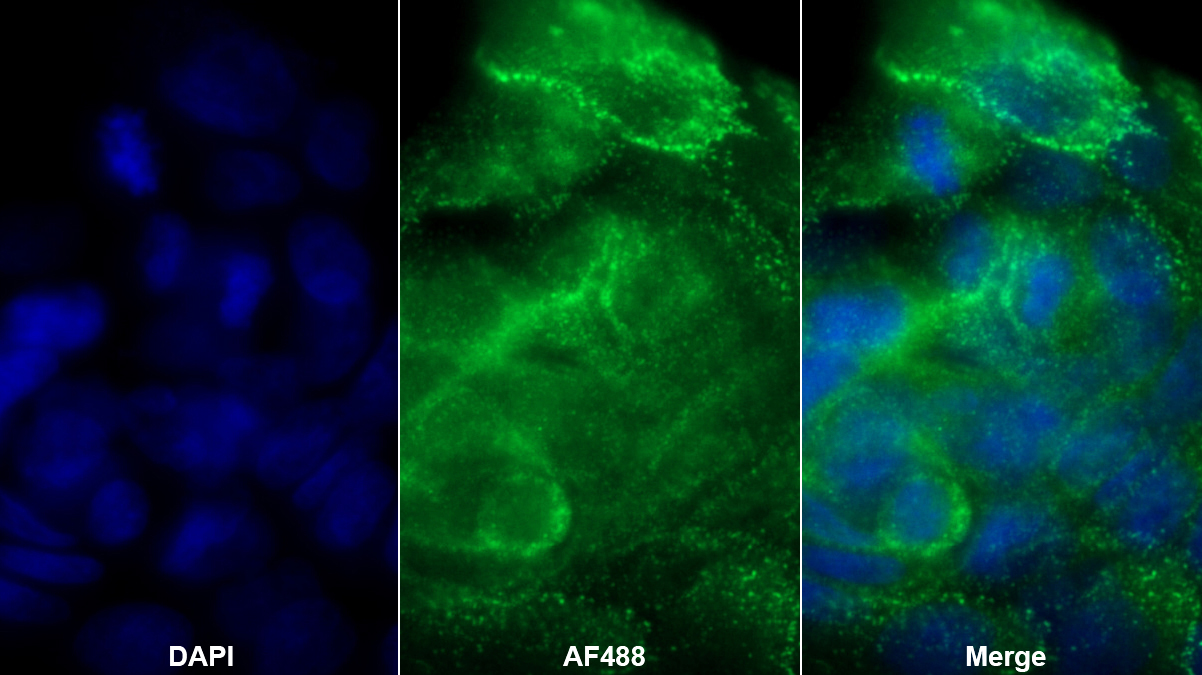 Monoclonal Antibody to Desmoplakin (DSP)