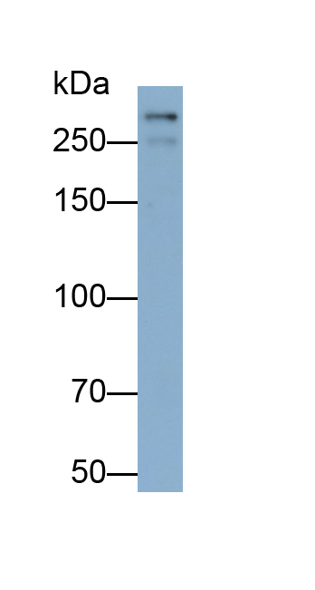 Monoclonal Antibody to Desmoplakin (DSP)