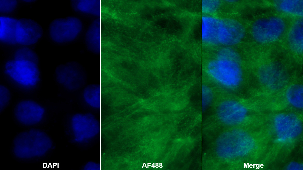 Monoclonal Antibody to Desmoplakin (DSP)