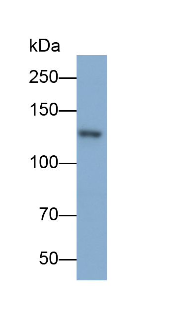 Monoclonal Antibody to Desmoplakin (DSP)