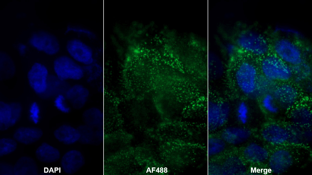 Monoclonal Antibody to Desmoplakin (DSP)