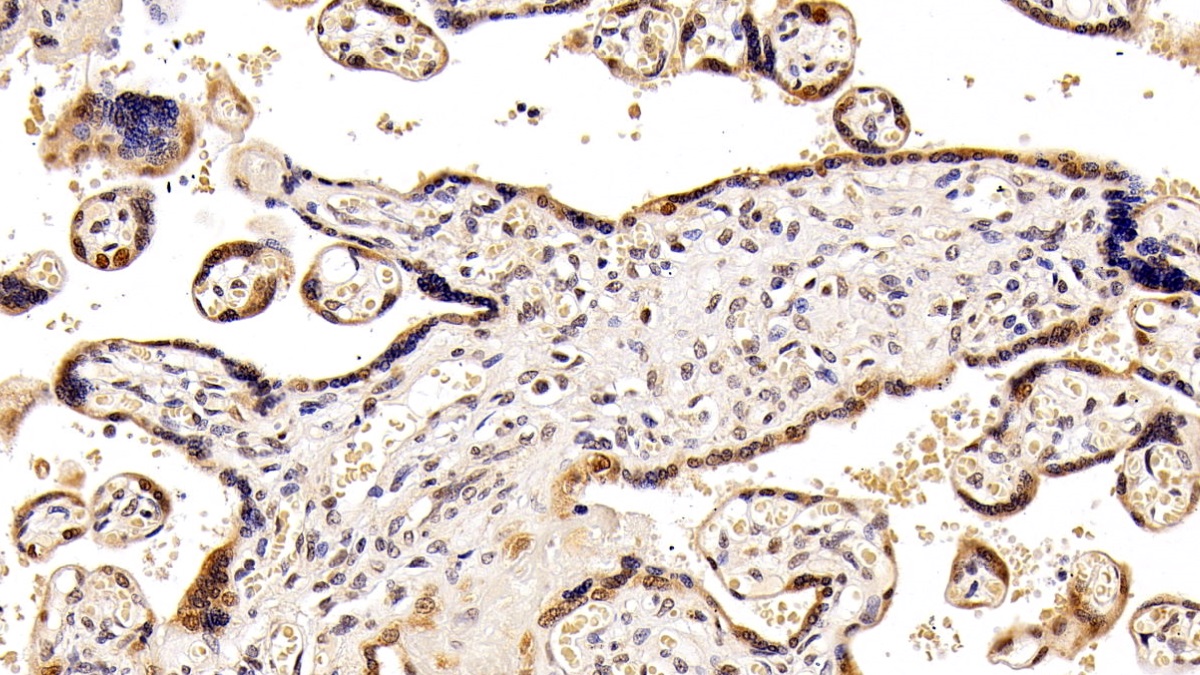 Monoclonal Antibody to Histone Deacetylase 1 (HDAC1)