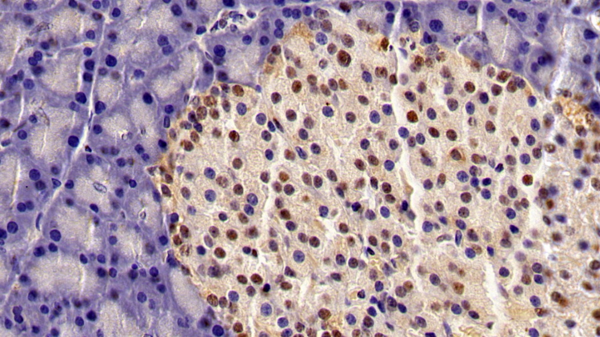 Monoclonal Antibody to Histone Deacetylase 1 (HDAC1)