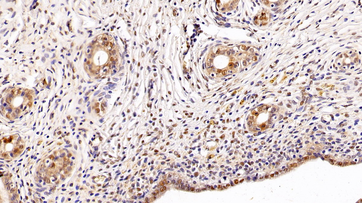 Monoclonal Antibody to Histone Deacetylase 1 (HDAC1)