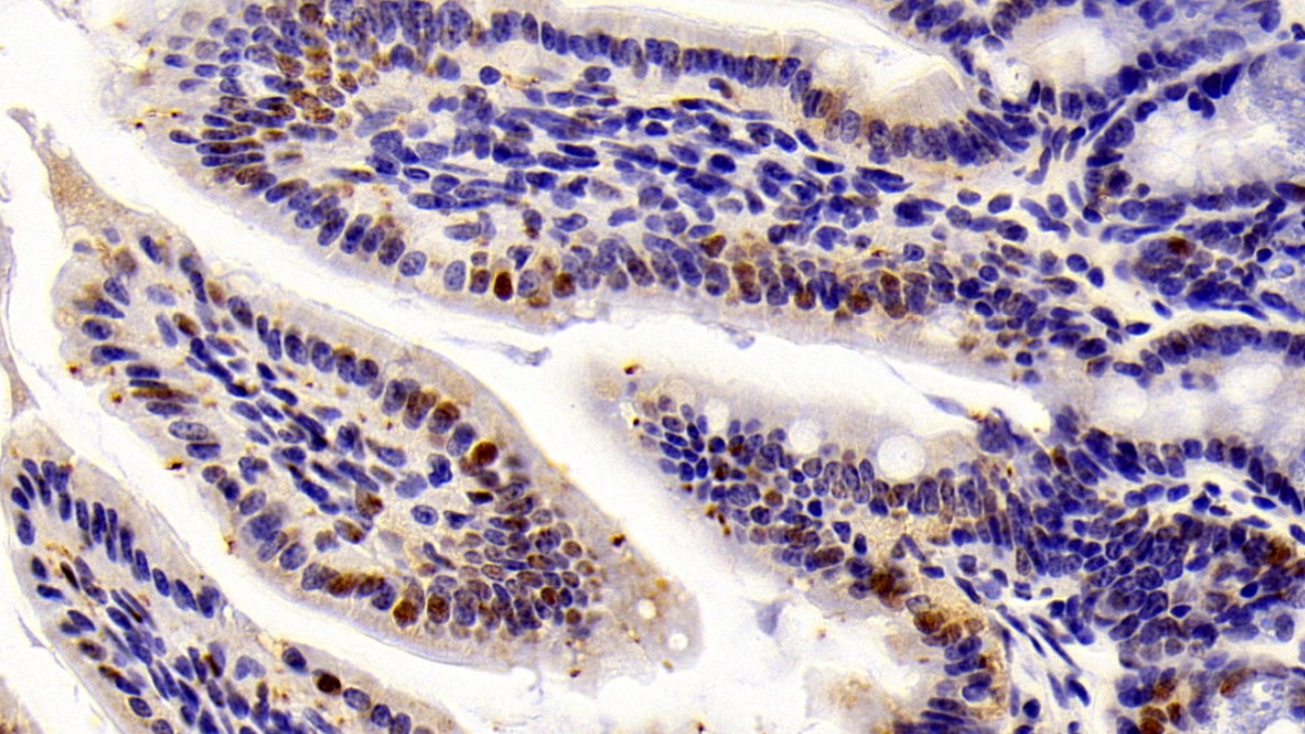 Monoclonal Antibody to Histone Deacetylase 1 (HDAC1)