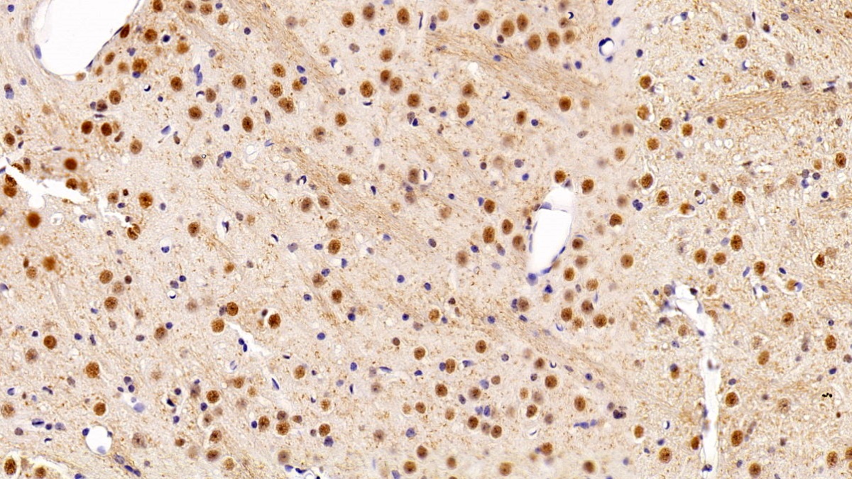 Monoclonal Antibody to Histone Deacetylase 1 (HDAC1)