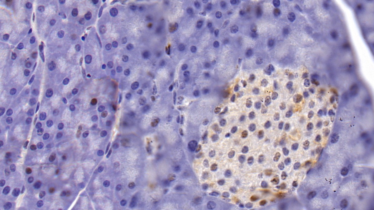 Monoclonal Antibody to Histone Deacetylase 1 (HDAC1)