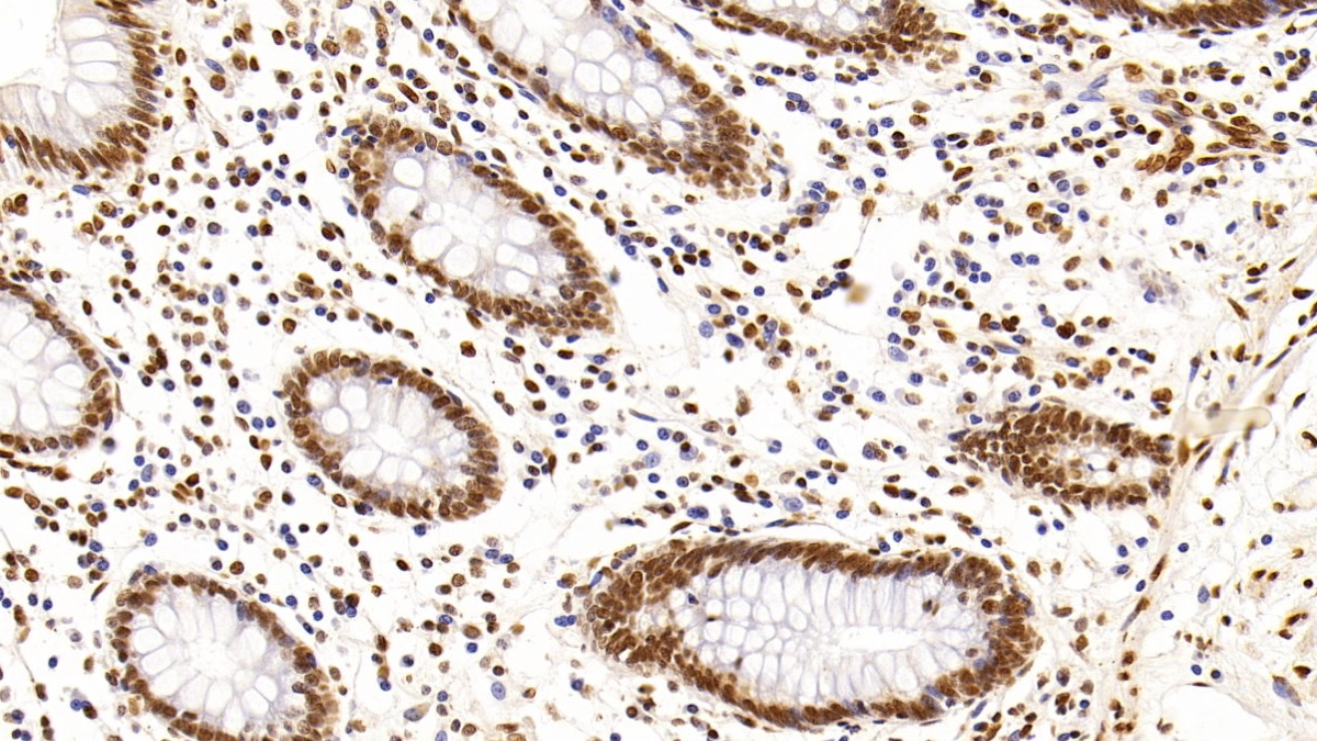 Monoclonal Antibody to Histone Deacetylase 1 (HDAC1)