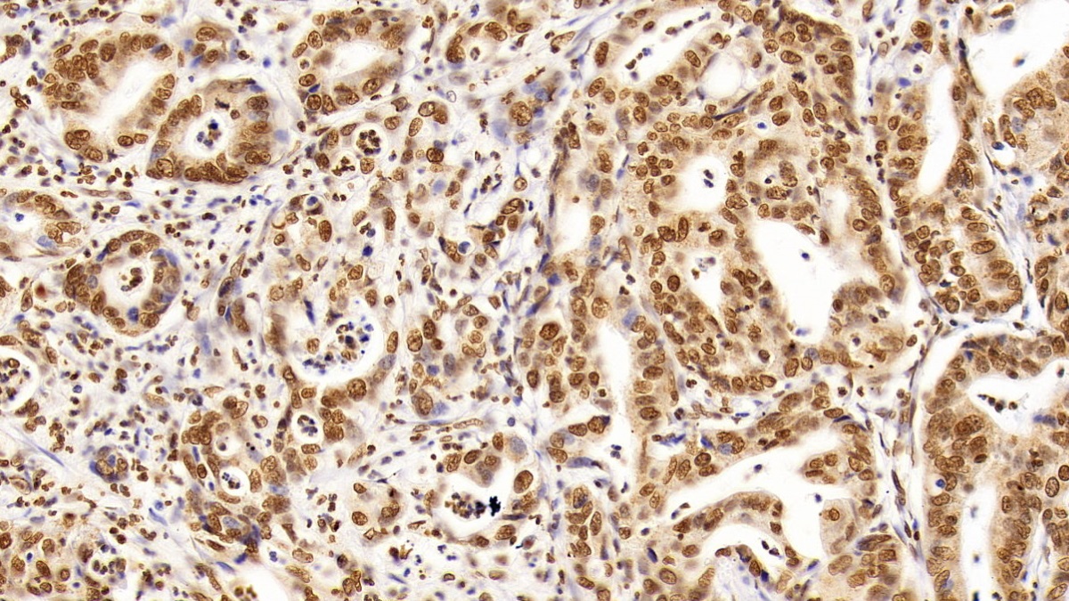 Monoclonal Antibody to Histone Deacetylase 1 (HDAC1)