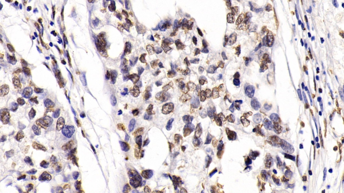 Monoclonal Antibody to Histone Deacetylase 1 (HDAC1)