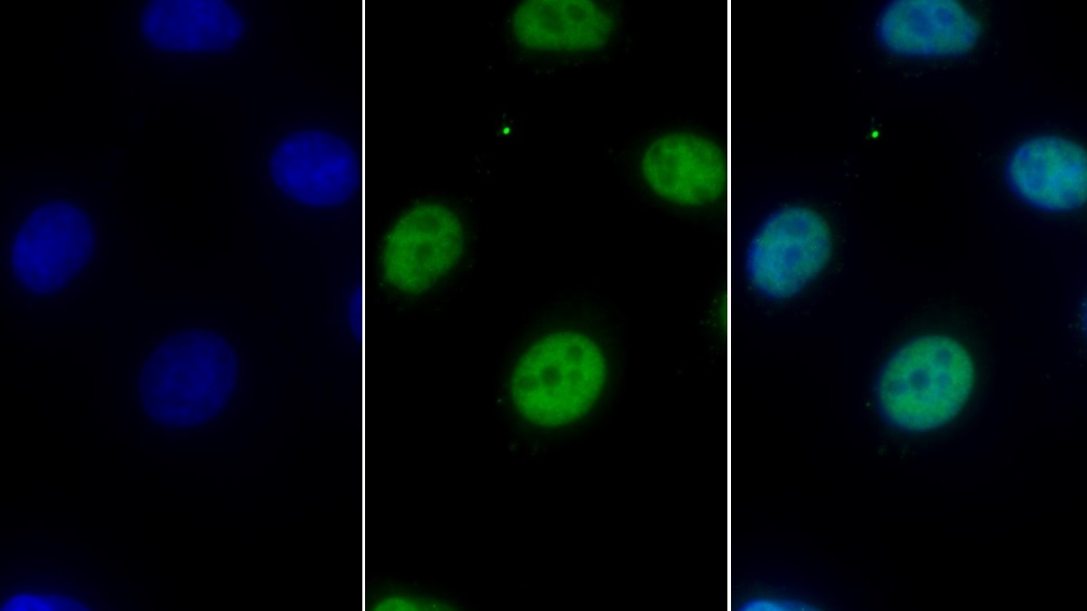 Monoclonal Antibody to Histone Deacetylase 1 (HDAC1)