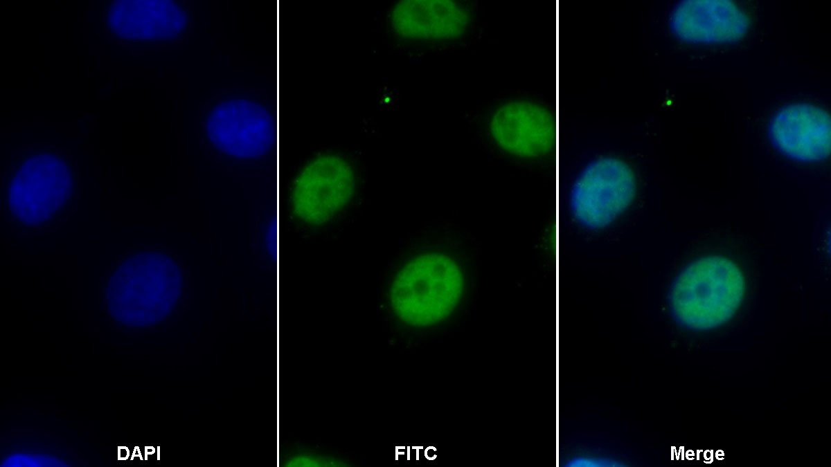 Monoclonal Antibody to Histone Deacetylase 1 (HDAC1)