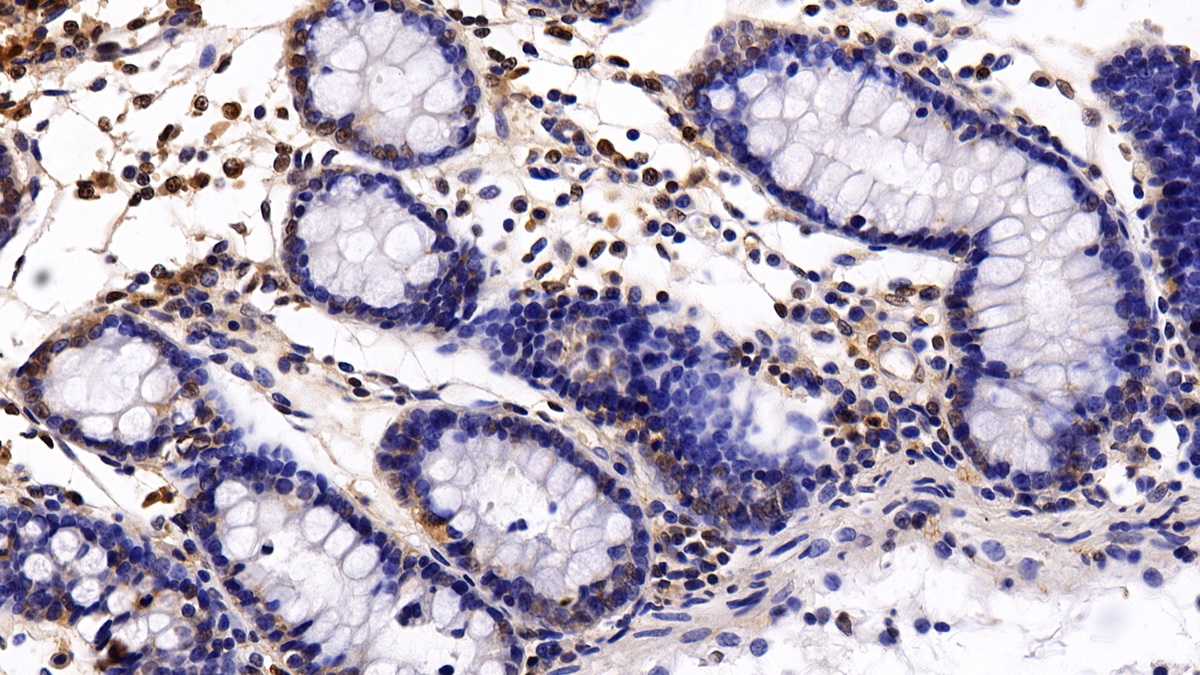 Monoclonal Antibody to Histone Deacetylase 1 (HDAC1)