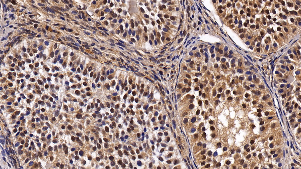 Monoclonal Antibody to Histone Deacetylase 1 (HDAC1)