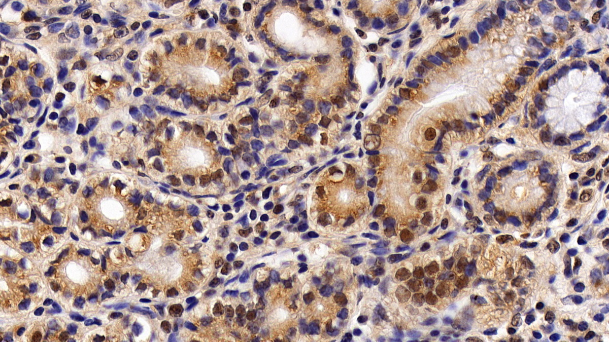 Monoclonal Antibody to Histone Deacetylase 1 (HDAC1)