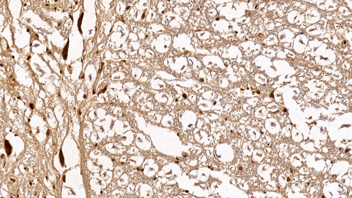 Monoclonal Antibody to Histone Deacetylase 1 (HDAC1)