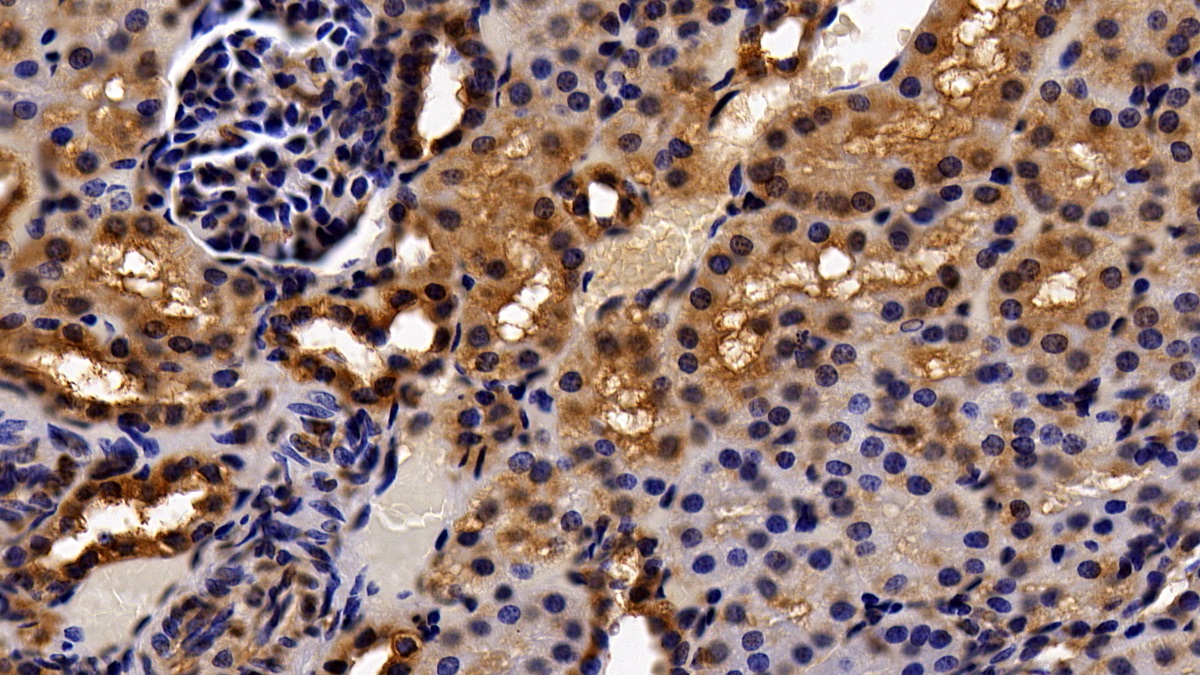 Monoclonal Antibody to Histone Deacetylase 1 (HDAC1)