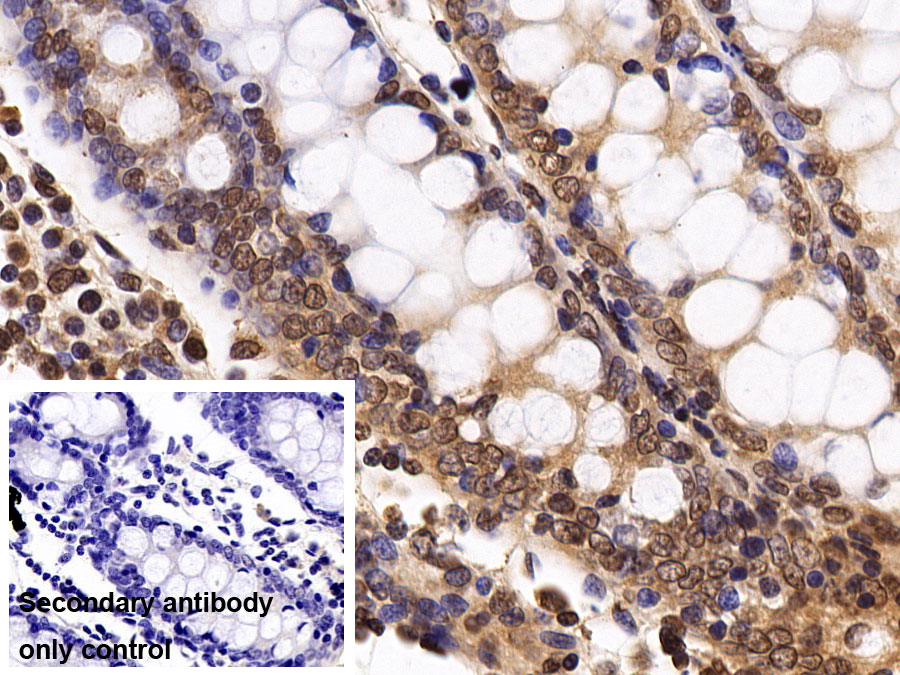 Monoclonal Antibody to Histone Deacetylase 1 (HDAC1)