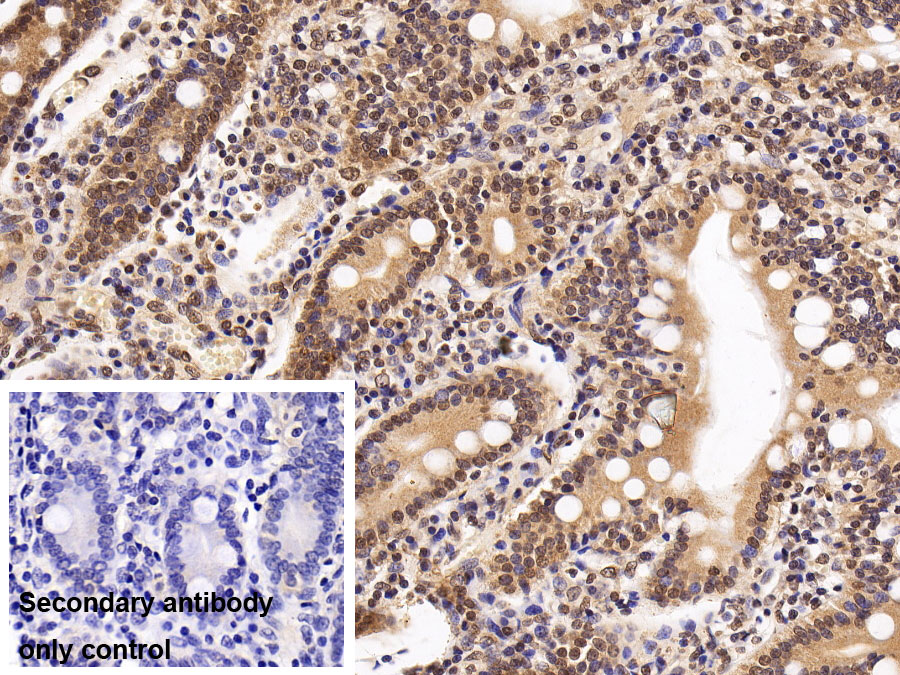 Monoclonal Antibody to Histone Deacetylase 1 (HDAC1)