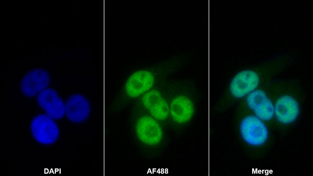 Monoclonal Antibody to Histone Deacetylase 1 (HDAC1)