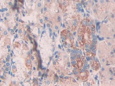 Monoclonal Antibody to Anterior Gradient 2 (AGR2)