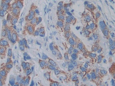 Monoclonal Antibody to Anterior Gradient 2 (AGR2)