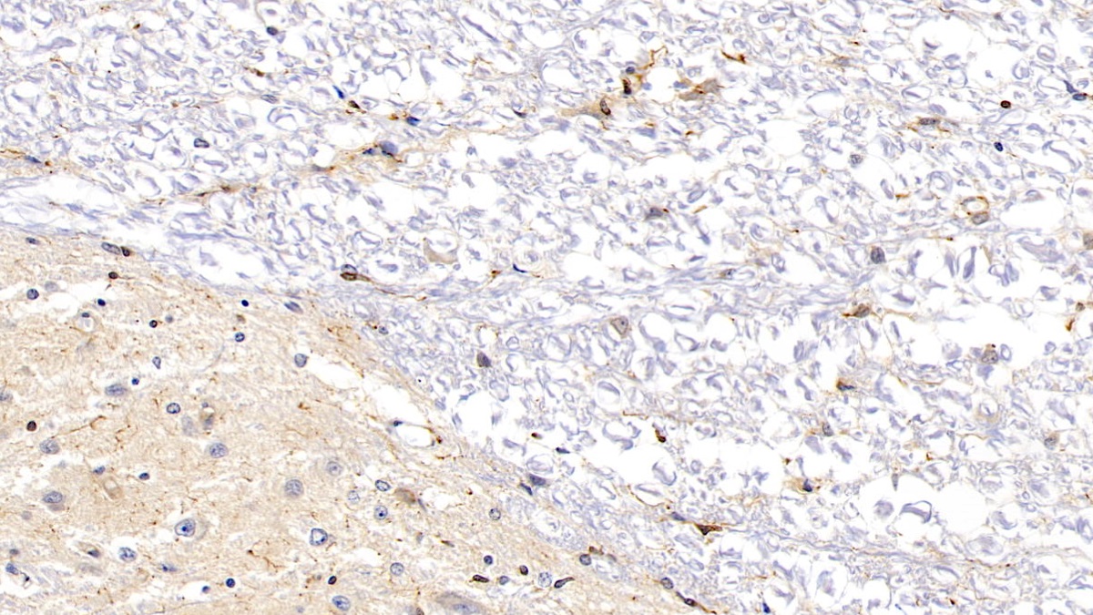 Monoclonal Antibody to Ionized Calcium-binding Adapter Molecule 1 (IBA1)