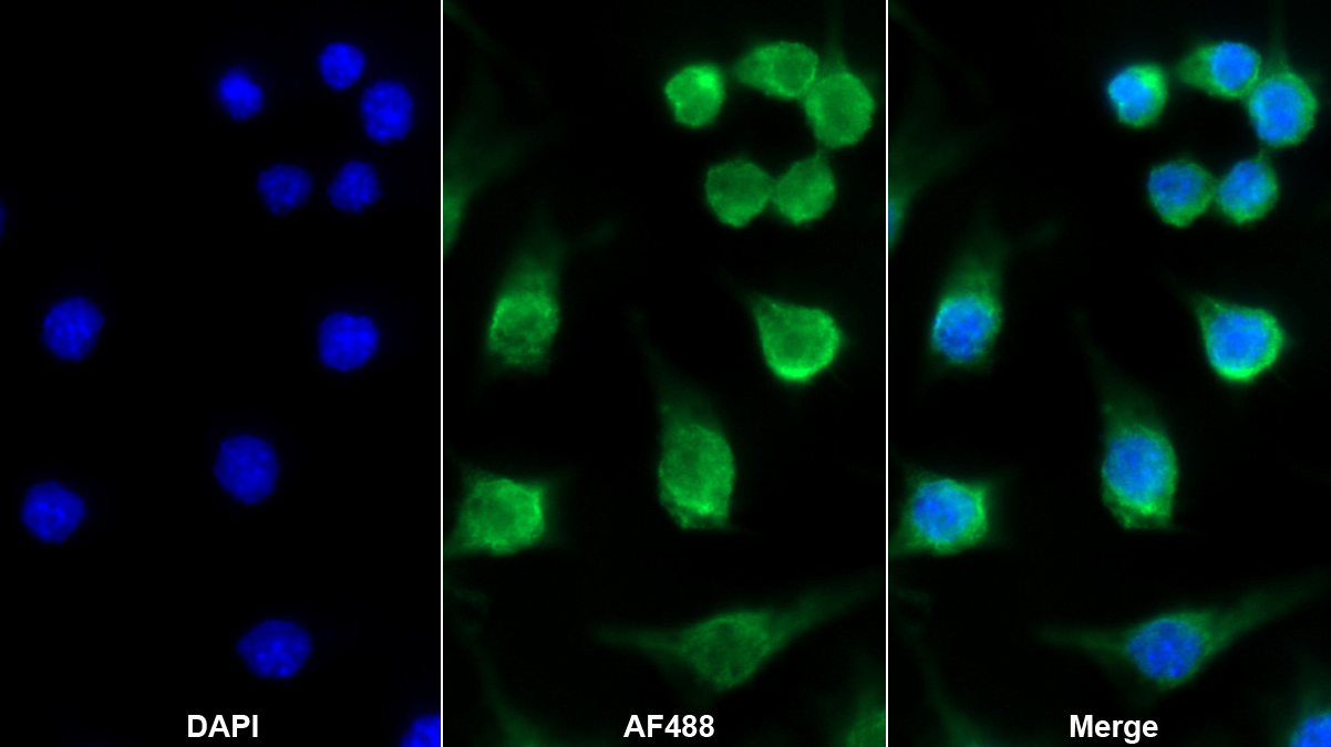 Monoclonal Antibody to Allograft inflammatory factor 1 (AIF1)